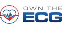 Own The ECG